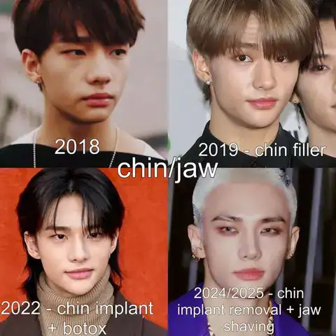 những câu nói hay về phẫu thuật thẩm mỹ những câu nói hay về phẫu thuật thẩm mỹ